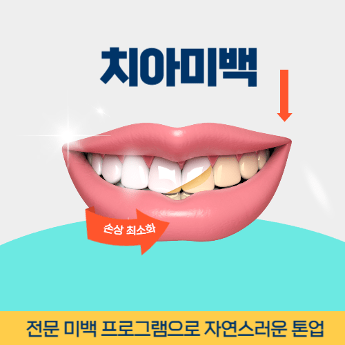 광양치과 광양시 치과 치아미백